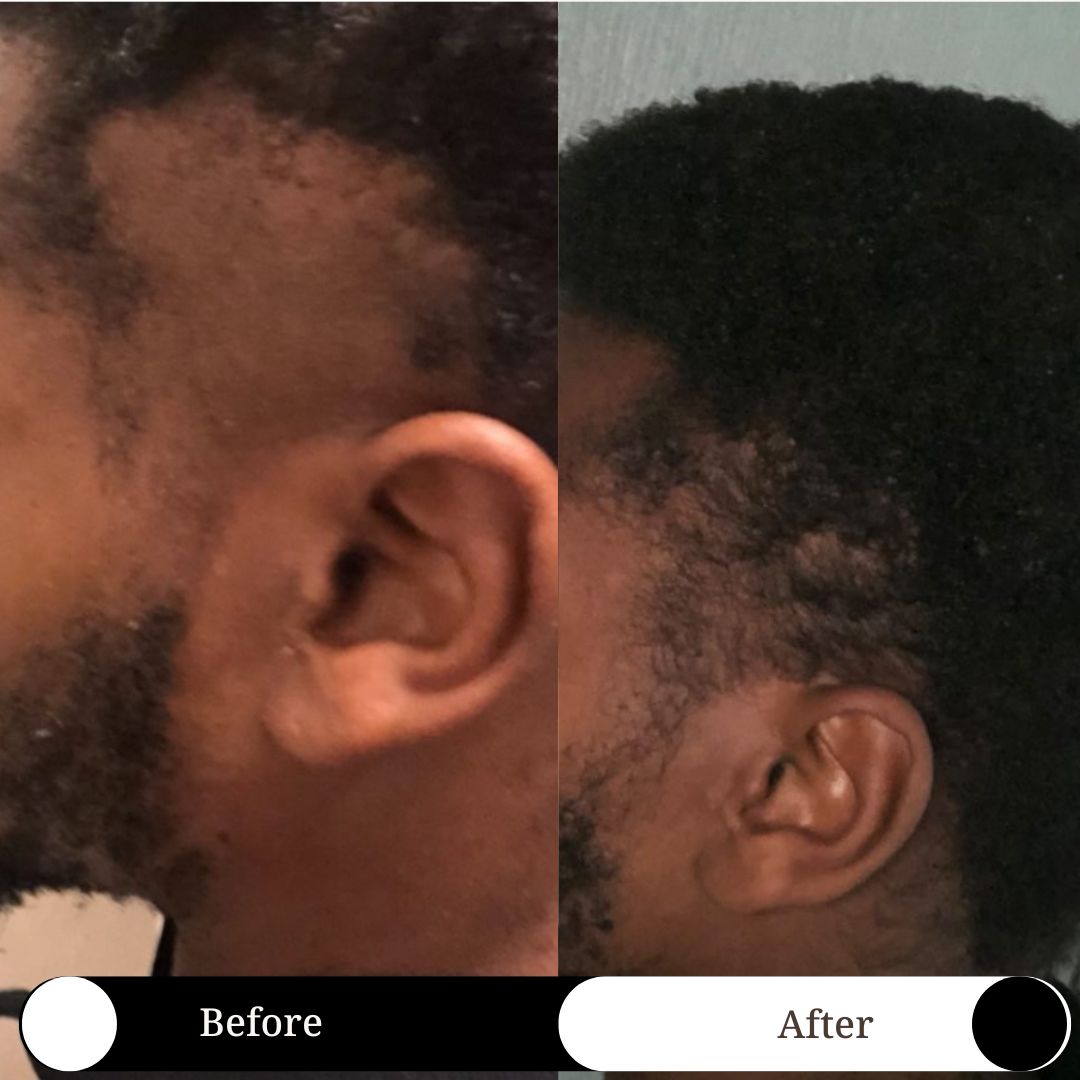 SET OF 4 - Hair Loss Recovery for Men Travel Size